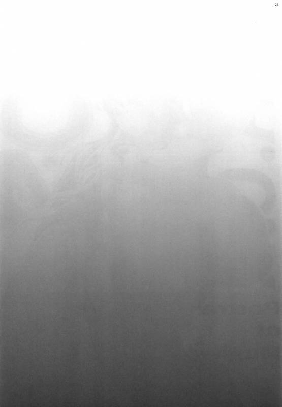 (COMIC1☆15) [Kocho Kocho Koukou (Bonten)] POM Soushuuhen (One Piece)_25